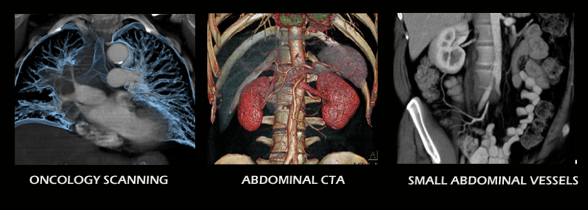 Abdominal Ultrasound Courses